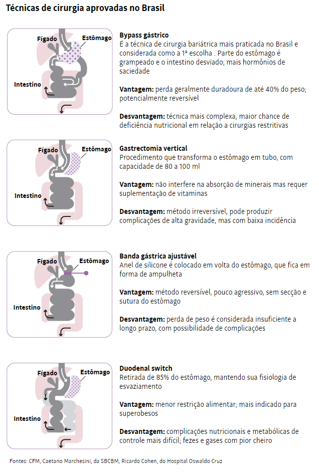 Técnicas de cirurgia aprovadas no Brasil