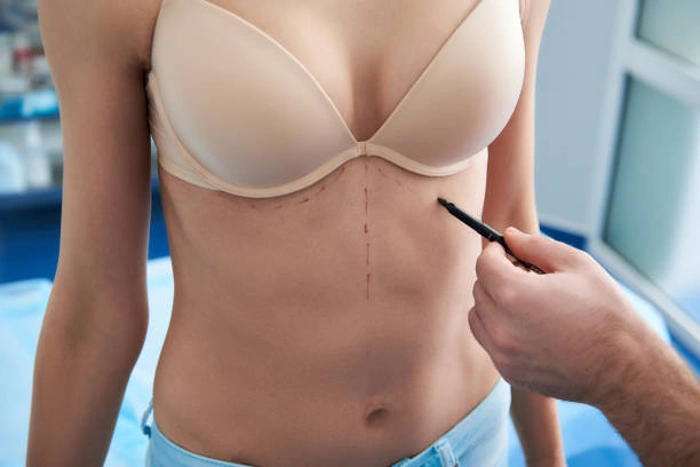 Médico aponta para corpo de mulher que está com sutiã. Falando sobre "plano de saúde cobre silicone?".